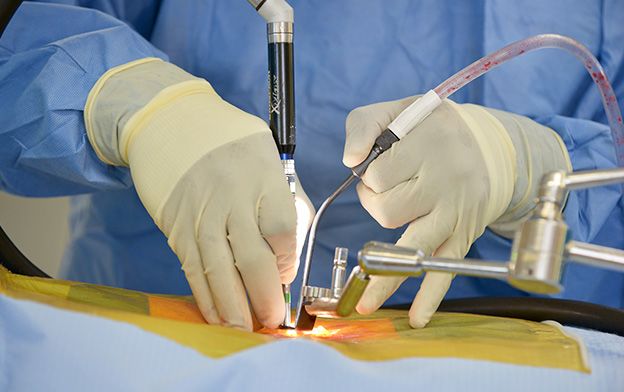 Minimally Invasive Surgery